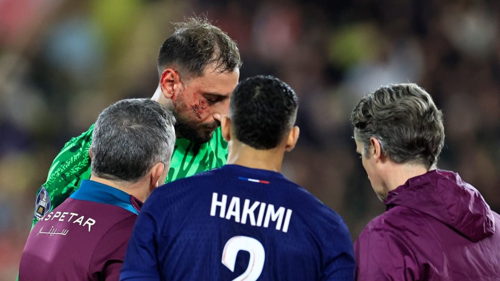 psg-keeper-donnarumma-suffers-horrific-facial-injury