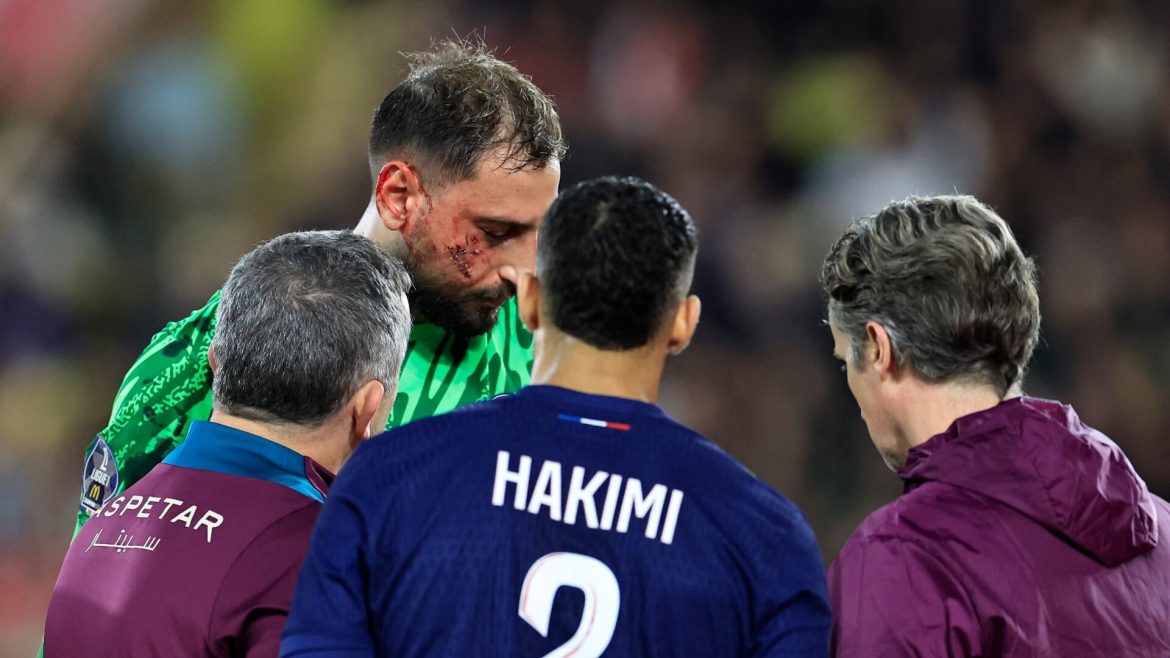 psg-keeper-donnarumma-suffers-horrific-facial-injury